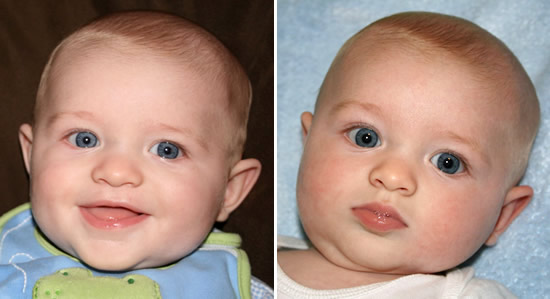 Riley, Nov. 2008 (5 months)